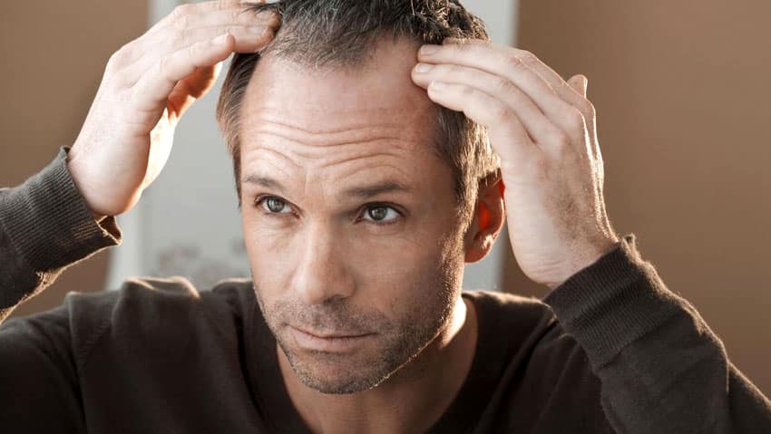 Nationaal Haarverlies Onderzoek nederland haarverlies
