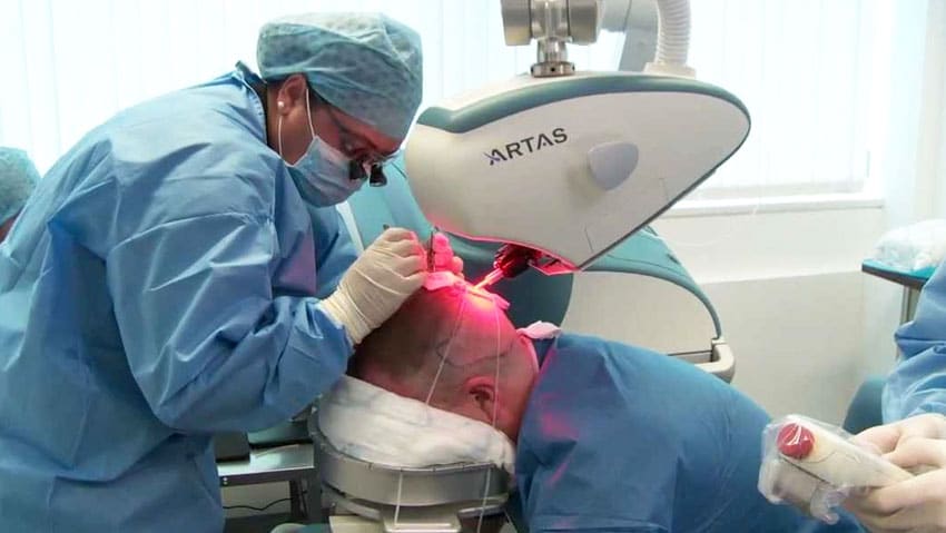 Artas haartransplantatie robot