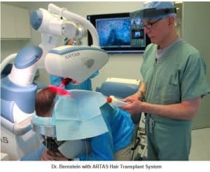 haartransplantatie robot