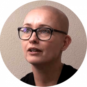 Alopecia en Micro Hair Pigmentation