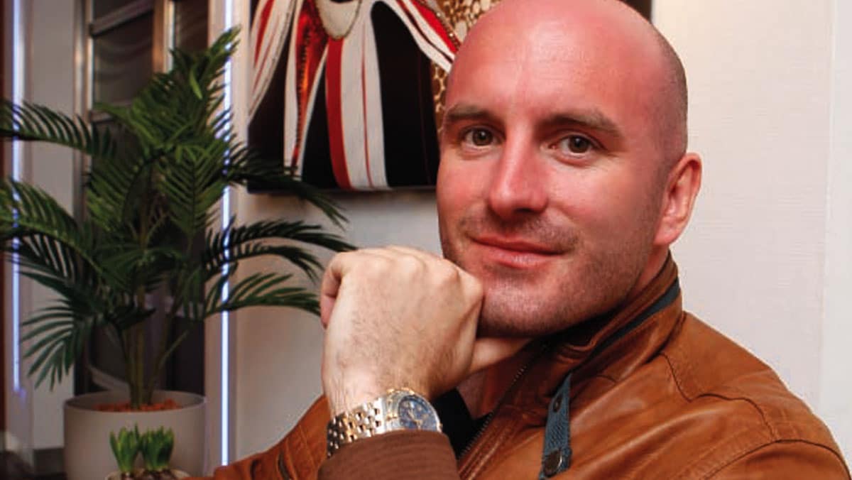 Dean Saunders haarproblemen haartransplantatie