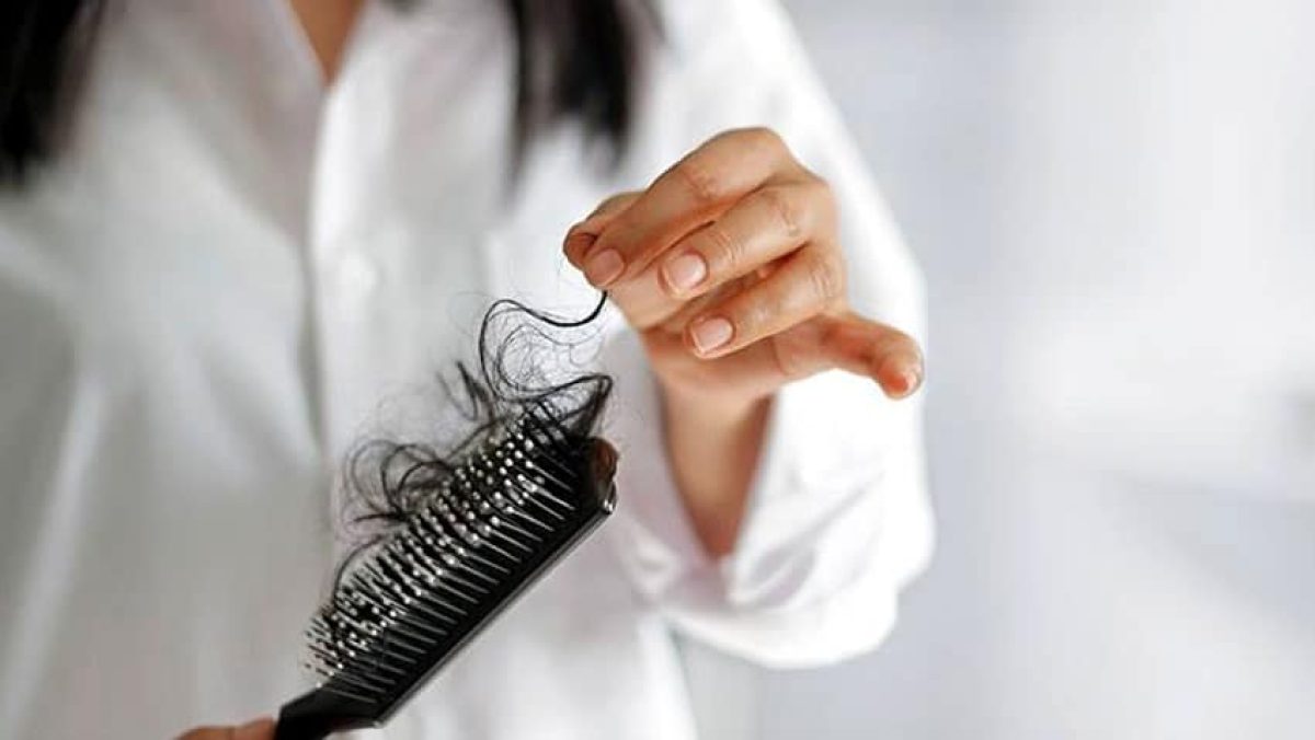 Haaruitval heeft een grote psychologische impact