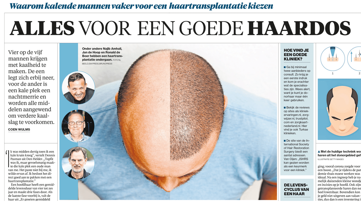 Waarom mannen kiezen voor een haartransplantatie