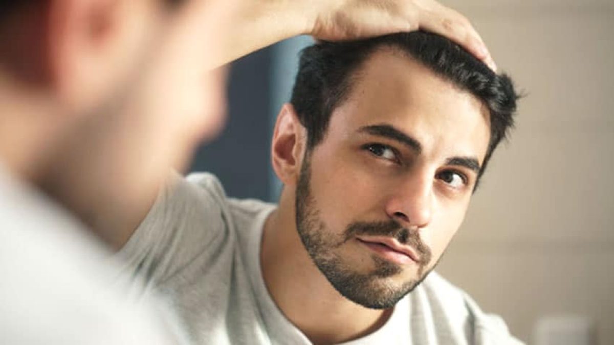 haartransplantatie schaamte